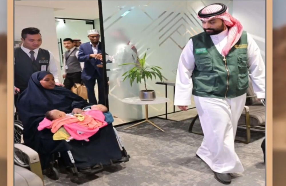 بدء تجهيزات عملية فصل التوأم الصومالي رحمة ورملا بالرياض