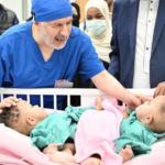 نجاح عملية فصل التوأم الصومالي رملا ورحمة في السعودية