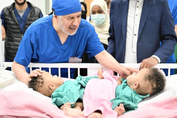 نجاح عملية فصل التوأم الصومالي رملا ورحمة في السعودية