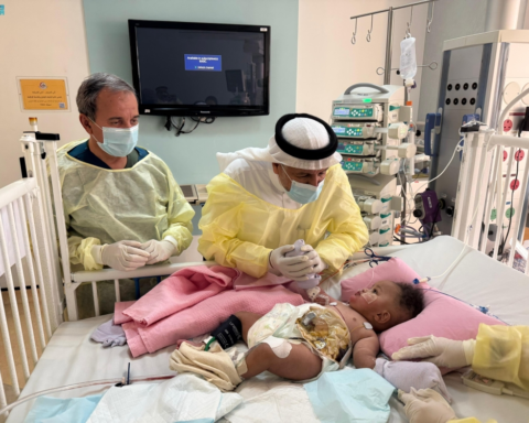 استقرار حالة رحمة ورملا بعد فصل التوأم الصومالي بنجاح